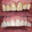 Thackeray Dental Care logo