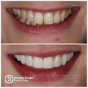 Bamber Bridge Dental Care logo
