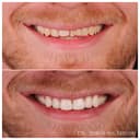 Towngate Dental Practice logo