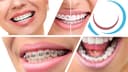 Birmingham Orthodontics logo