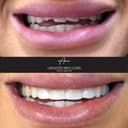 Lancaster Smile Clinic logo