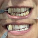 Smiles on Harrogate Road - Dentist in Leeds logo