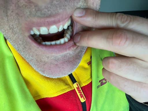 Dental Perfection Kettering logo