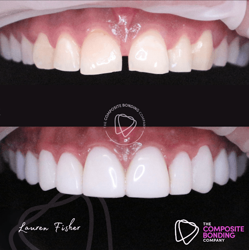 The Composite Bonding Company logo