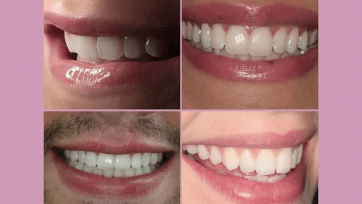 Manor House Dental | Composite Bonding Birmingham logo