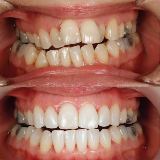 Dr Tom Lotka - Invisalign Sheffield logo